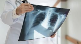 Рентген грудной клетки, рентген позвоночника, рентген головы, рентген конечностей, рентген суставов, рентген пазух носа со скидкой 50% от медицинской