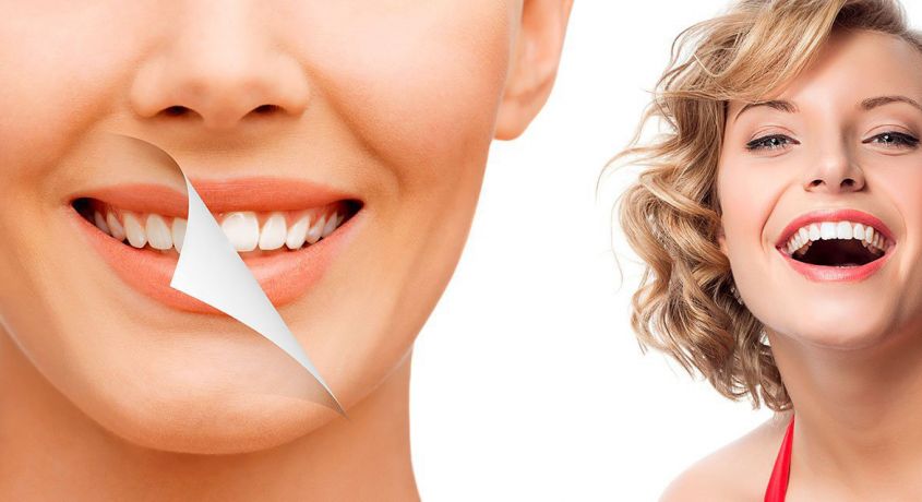 До 50 % скидки на Отбеливание зубов Amazing White Professional от Стоматологической клиники «VivaStom»