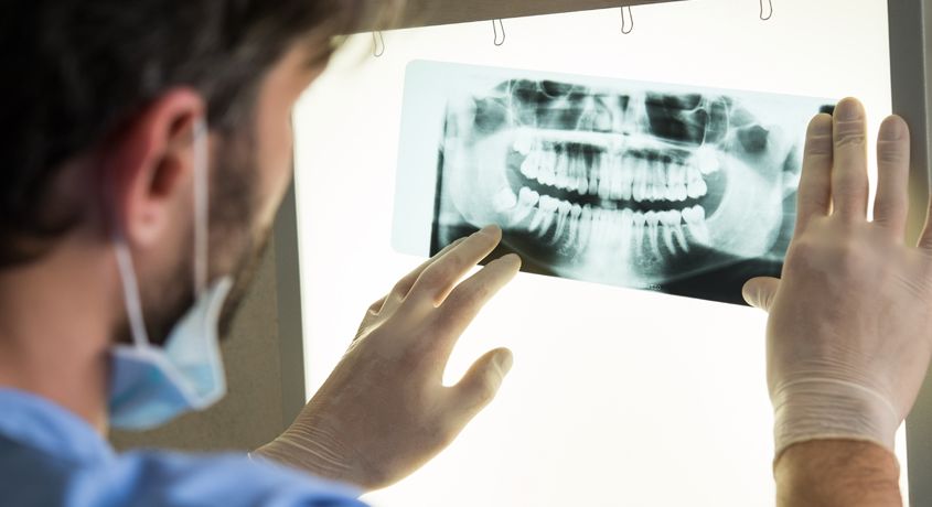 Скидка 50% на снимки зубов КТ, ОПТГ, ТРГ в стоматологической клинике Oxford Smile