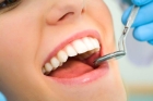 Прием стоматолога ортопеда (повторный)