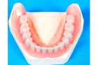 Зубной нижний протез