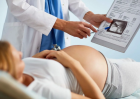 Ведение многоплодной беременности