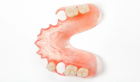 Нейлоновый протез на 4 и более  зубов