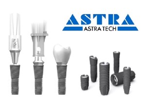 Имплант Astra-Tech ( Швеция)