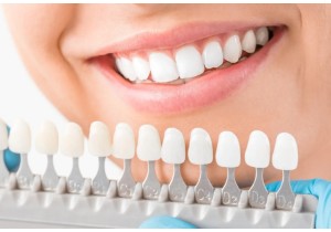 Химическое отбеливание зубов с использованием систем «Opalescence Boost»