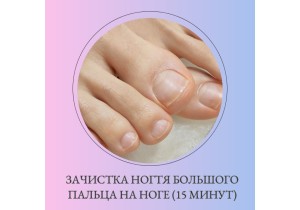 Зачистка ногтя большого пальца на ноге