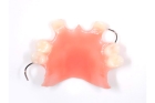 Съемный протез с искусственными зубами