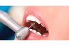 Лечение корня зуба