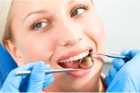 Гигиена полости рта, чистка Air-Flow, 1 зуб