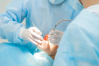 Цистоэктомия с резекцией верхушки корня зуба 