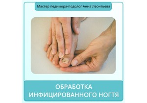 Обработка инфицированного ногтя