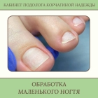 Обработка инфицированной/утолщенной ногтевой пластины (маленький ноготь)